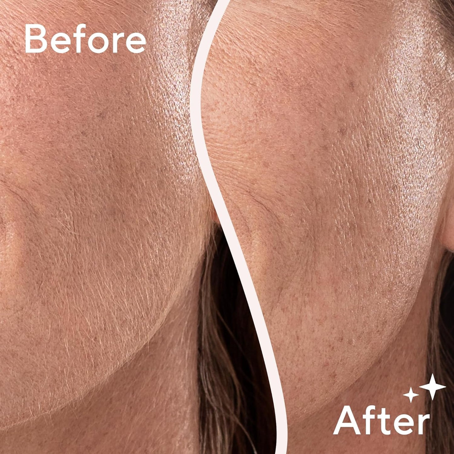 Flawless Dermaplane Glo Sonic