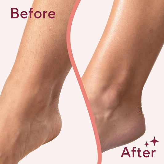 Flawless Legs, Electric Razor for Women