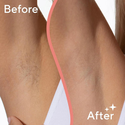 Flawless Underarm Hair Removal Electric Razor Device