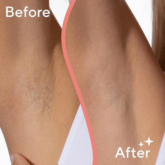 Flawless Underarm Hair Removal Electric Razor Device