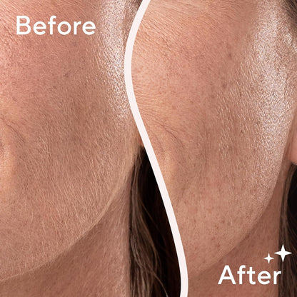 Flawless Dermaplane Glo Sonic